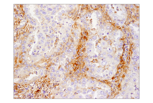 Immunohistochemistry Image 2: B7-H3 (D9M2L) XP<sup>®</sup> Rabbit mAb (BSA and Azide Free)