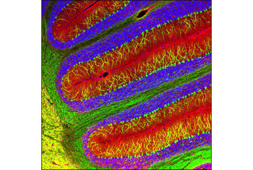undefined Image 18: Demyelinating Disease Targets Antibody Sampler Kit