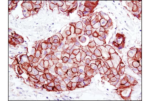 undefined Image 62: Lung Cancer RTK Antibody Sampler Kit