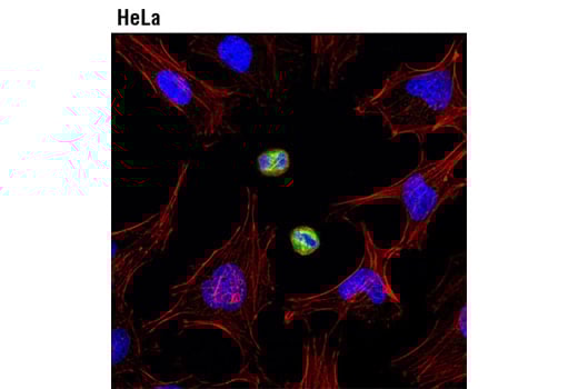 Immunofluorescence Image 1: Phospho-Vimentin (Ser83) (D5A2D) Rabbit mAb