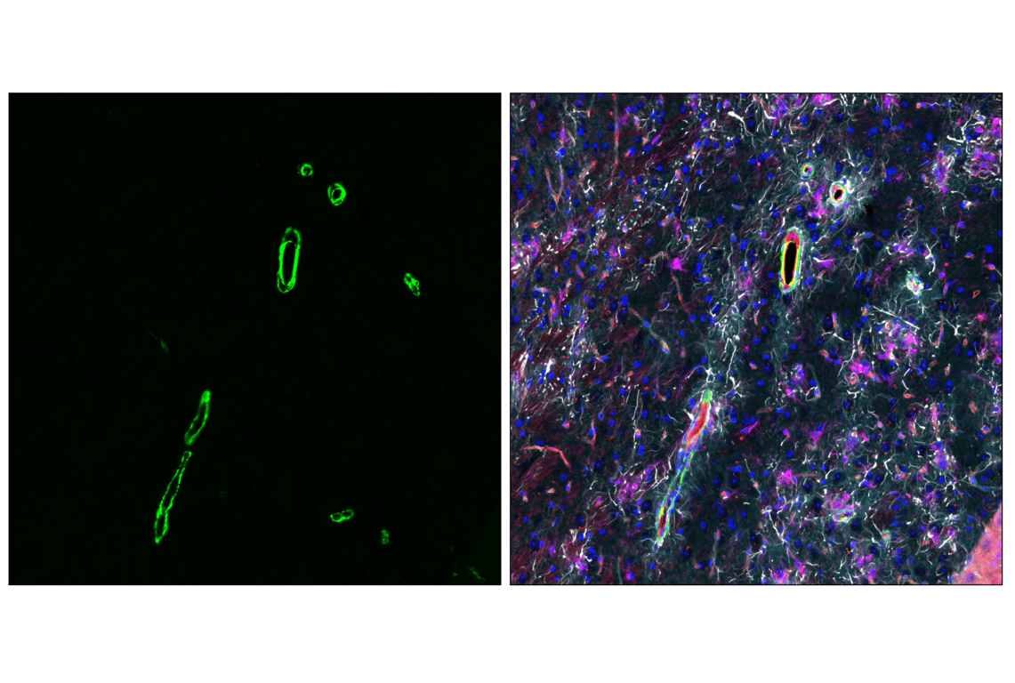 Immunofluorescence Image 2: α-Smooth Muscle Actin (1A4) Mouse mAb (Alexa Fluor<sup>®</sup> 488 Conjugate)