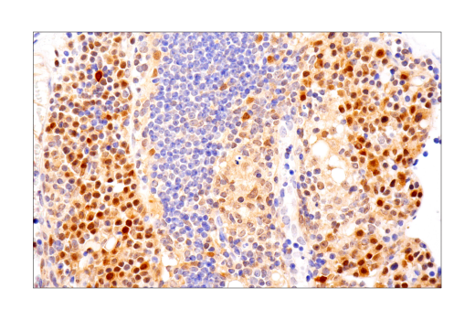 Immunohistochemistry Image 5: ASC/TMS1 (D2W8U) Rabbit mAb