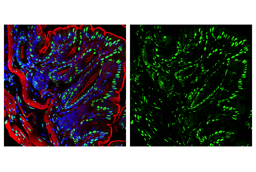 Immunofluorescence Image 3: FUS/TLS (E3O8I) Rabbit mAb (BSA and Azide Free)