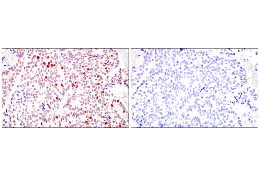 Immunohistochemistry Image 4: DNMT1 (D63A6) XP<sup>®</sup> Rabbit mAb (BSA and Azide Free)