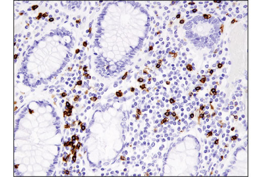 undefined Image 23: Human Exhausted CD8<sup>+</sup> T Cell IHC Antibody Sampler Kit