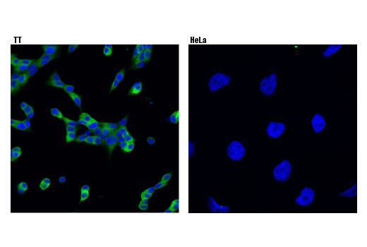 Immunofluorescence Image 1: Ret (E1N8X) XP<sup>®</sup> Rabbit mAb (BSA and Azide Free)