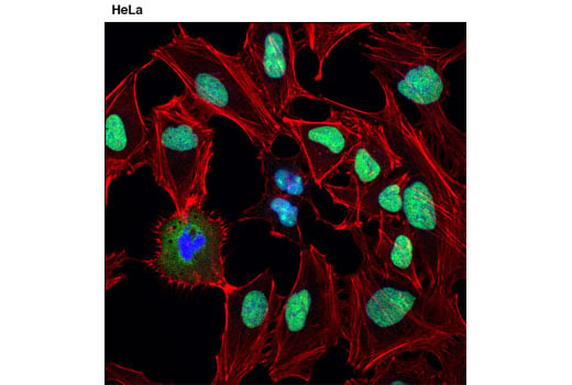 Immunofluorescence Image 1: DDX5 (D15E10) XP<sup>®</sup> Rabbit mAb (BSA and Azide Free)