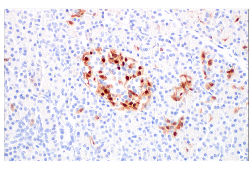 Immunohistochemistry Image 8: p16 INK4A (BC42) Mouse mAb
