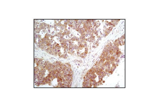 undefined Image 5: PhosphoPlus<sup>®</sup> eIF2α (Ser51) Antibody Duet