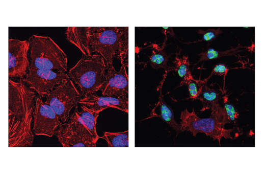 undefined Image 30: Apoptosis Antibody Sampler Kit II