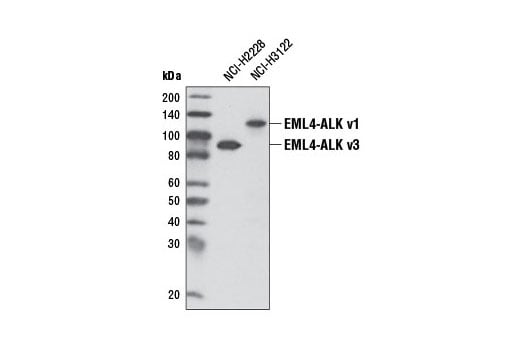Western Blotting Image 1: ALK (D5F3<sup>®</sup>) XP<sup>®</sup> Rabbit mAb