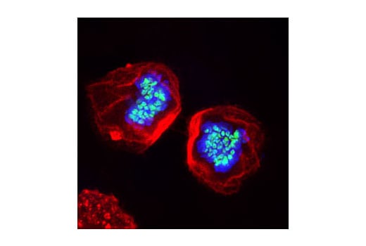 undefined Image 16: Aurora A/B Substrate Antibody Sampler Kit