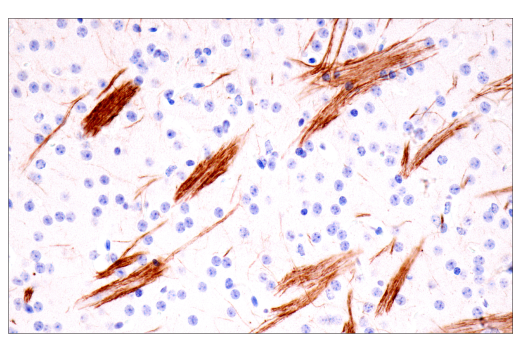 Immunohistochemistry Image 3: Neurofilament-H (E7Z7G) Rabbit mAb