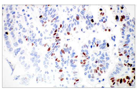 Immunohistochemistry Image 5: MAGE-C2/CT10 (E7B8D) XP<sup>®</sup> Rabbit mAb