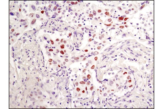 undefined Image 10: PhosphoPlus<sup>®</sup> c-Jun (Ser73) Antibody Duet