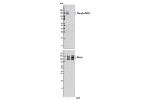 Western Blotting Image 2: Phospho-FGF Receptor (Tyr653/654) (55H2) Mouse mAb