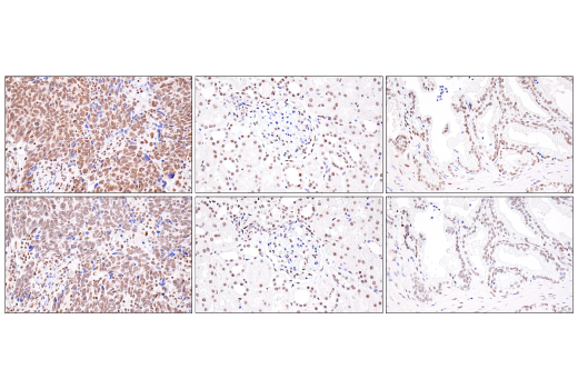 Immunohistochemistry Image 1: BRD4 (E2A7X) Rabbit mAb