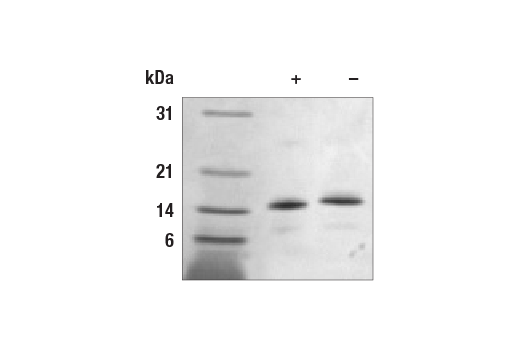 undefined Image 1: Human Amphiregulin Recombinant Protein