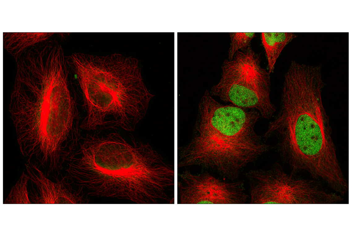 Immunofluorescence Image 1: Phospho-Stat3 (Tyr705) (M9C6) Mouse mAb