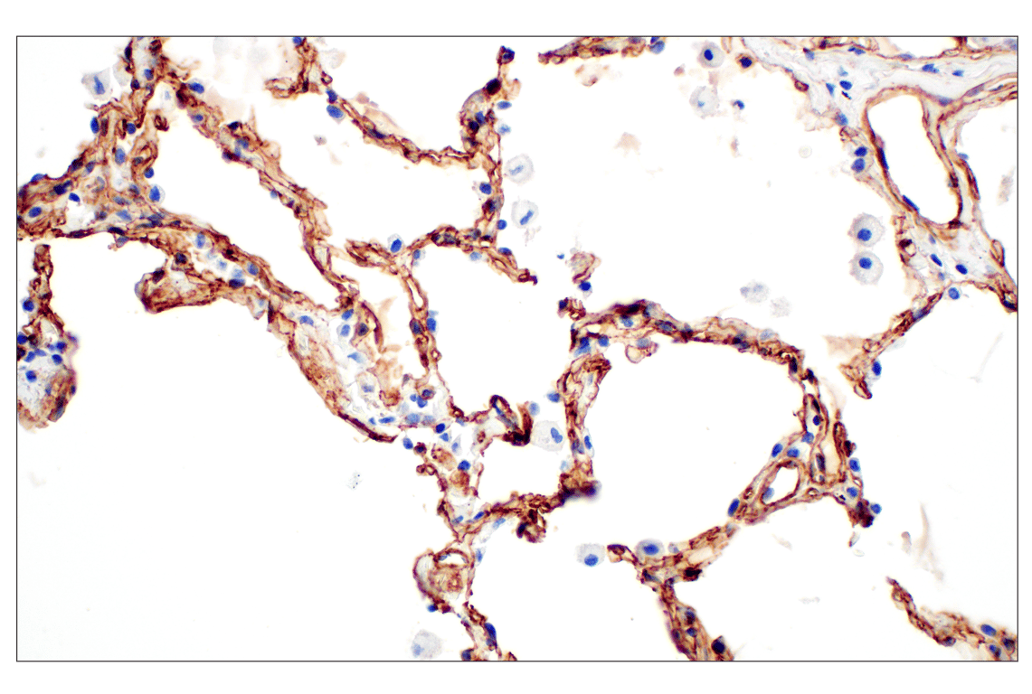Immunohistochemistry Image 5: COL4A1 (E5M6R) Rabbit mAb (IHC Formulated)