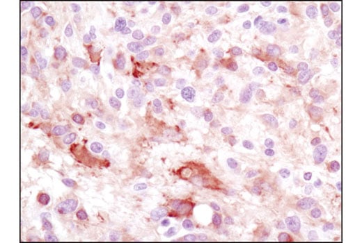Immunohistochemistry Image 1: LC3A (D50G8) XP<sup>®</sup> Rabbit mAb