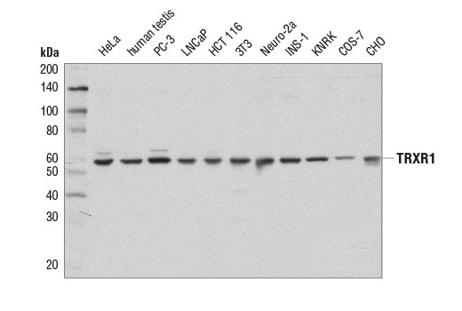Western Blotting Image 1: TRXR1 (D1T3D) Rabbit mAb