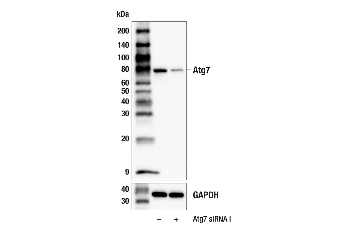 Western Blotting Image 1: Atg7 (F4V2N) Rabbit mAb