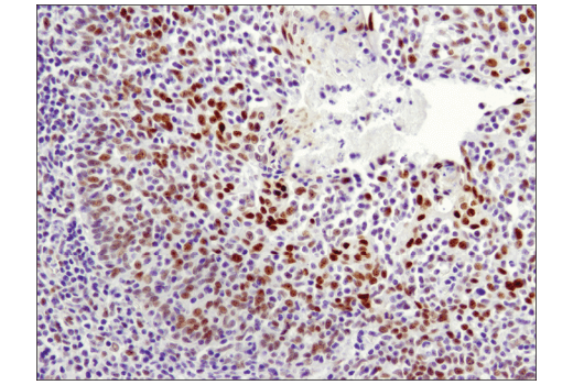 Immunohistochemistry Image 5: LRF/Pokemon (D7U2O) Rabbit mAb