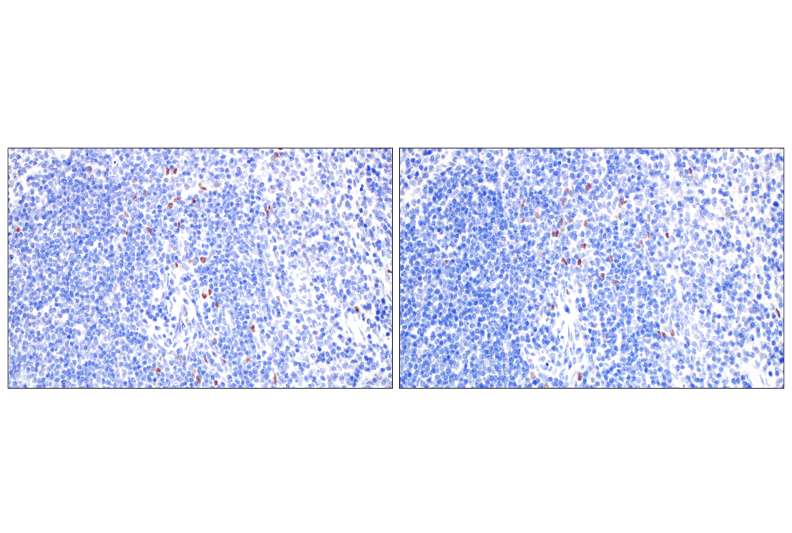 Immunohistochemistry Image 8: TCF4/ITF2 (E3X2Y) Rabbit mAb