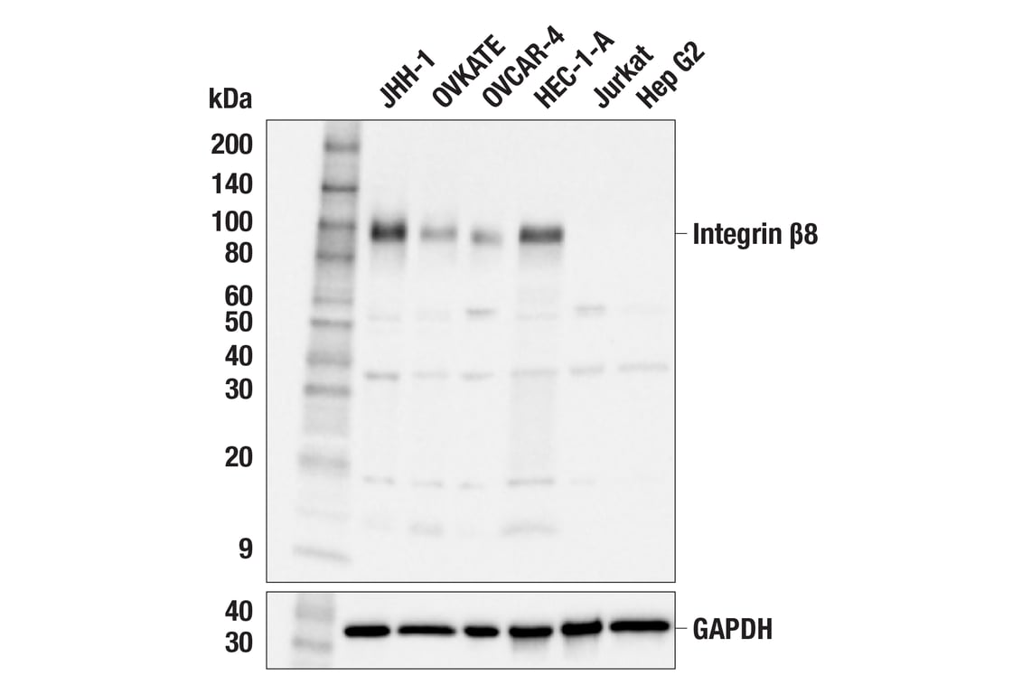 Western Blotting Image 1: Integrin β8 (F1H4B) Rabbit mAb