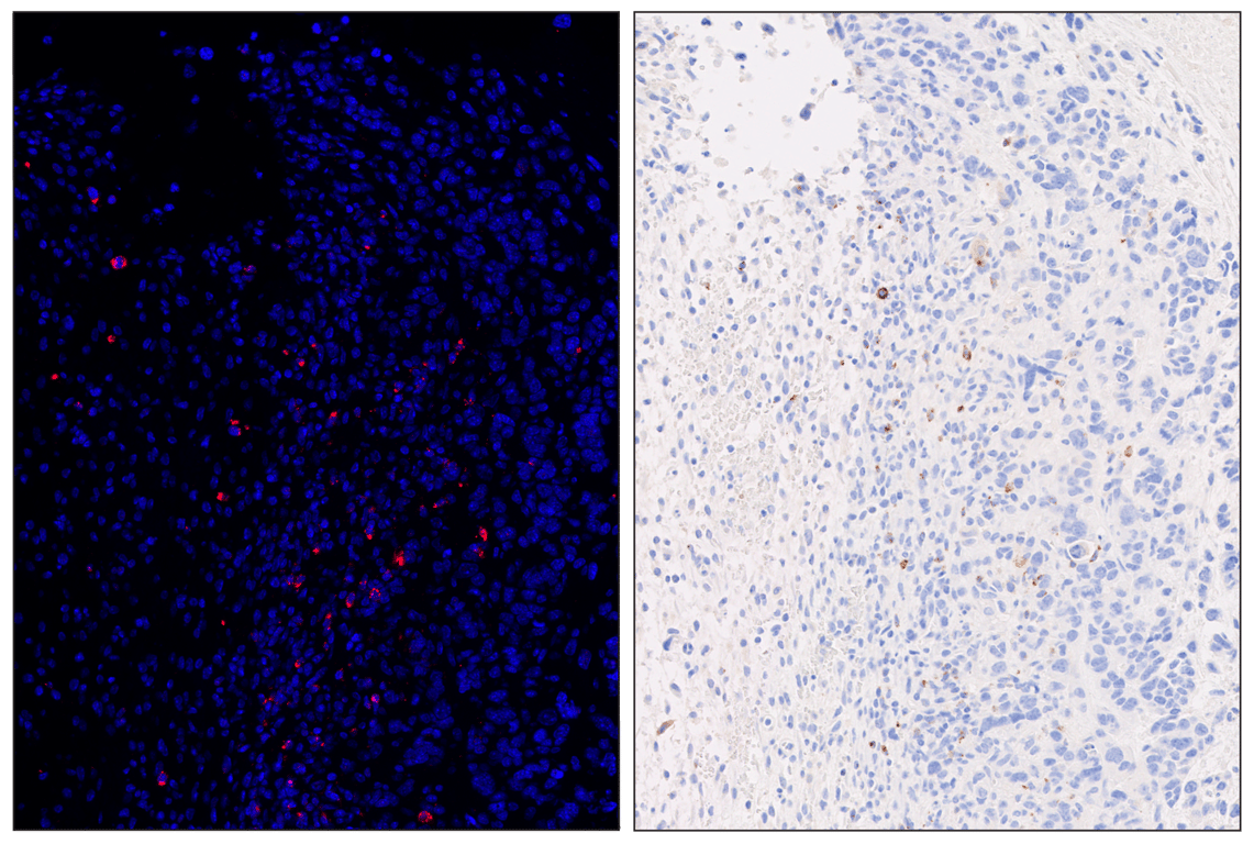 Immunohistochemistry Image 6: Granzyme B (E5V2L) & CO-0049-647 SignalStar<sup>™</sup> Oligo-Antibody Pair