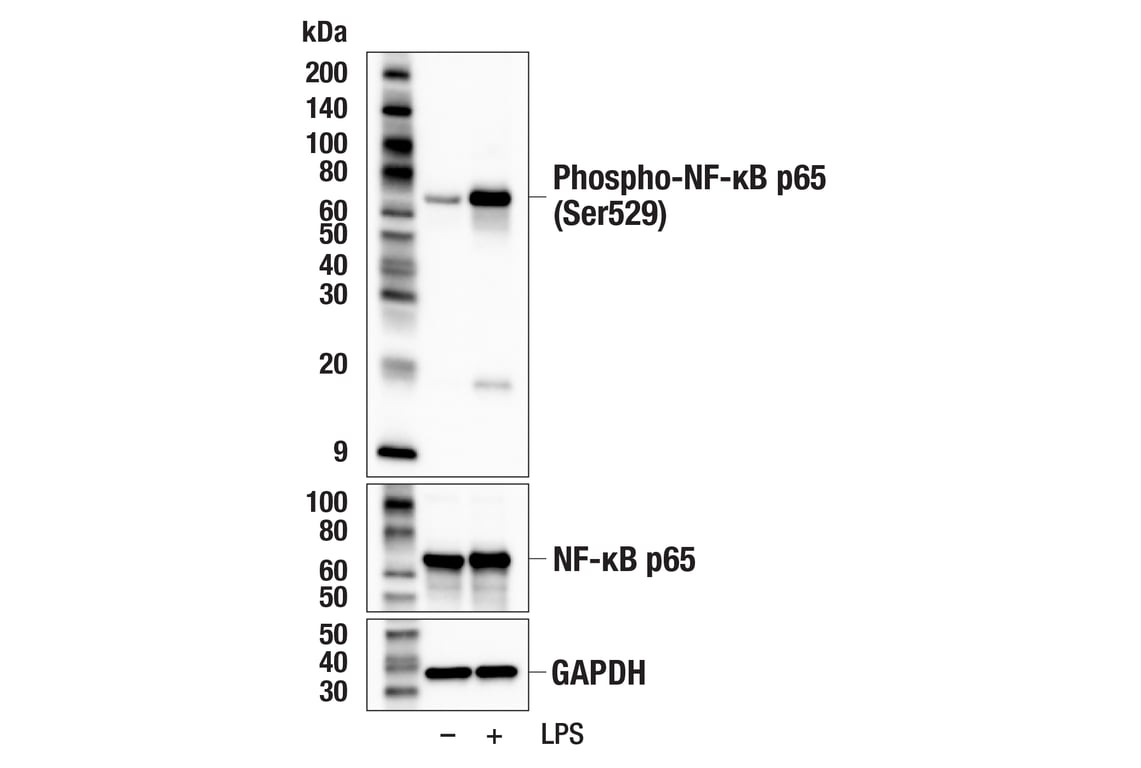 Western Blotting Image 1: Phospho-NF-κB p65 (Ser529) (E3K3J) Rabbit mAb
