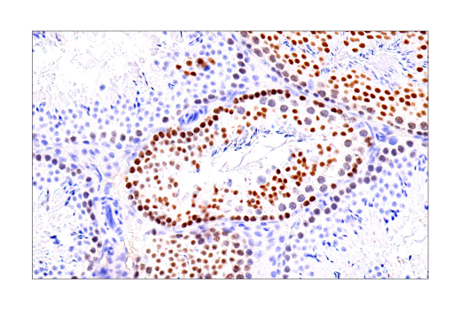 Immunohistochemistry Image 8: ATAD2 (E8Y7F) Rabbit mAb