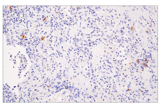 Immunohistochemistry Image 2: XCR1 (D2F8T) Rabbit mAb (BSA and Azide Free)