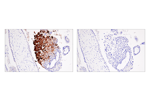 Immunohistochemistry Image 2: HLA-G (E8N9C) XP<sup>®</sup> Rabbit mAb