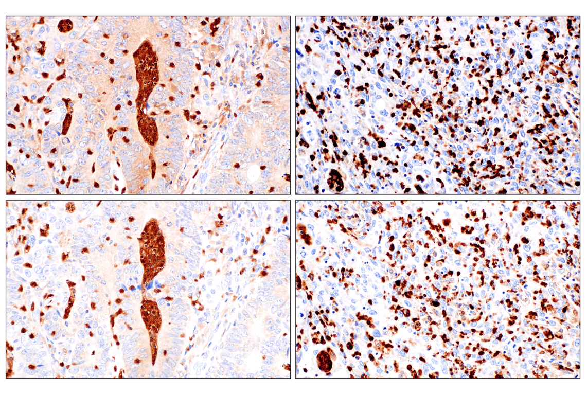 Immunohistochemistry Image 8: Catalase (D4P7B) XP<sup>®</sup> Rabbit mAb