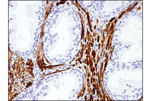 Immunohistochemistry Image 4: UCHL1 (D3T2E) XP<sup>®</sup> Rabbit mAb