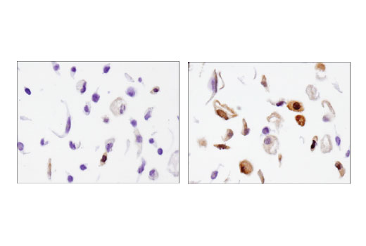 Immunohistochemistry Image 3: β-Arrestin 1 (D7Z3W) XP<sup>®</sup> Rabbit mAb