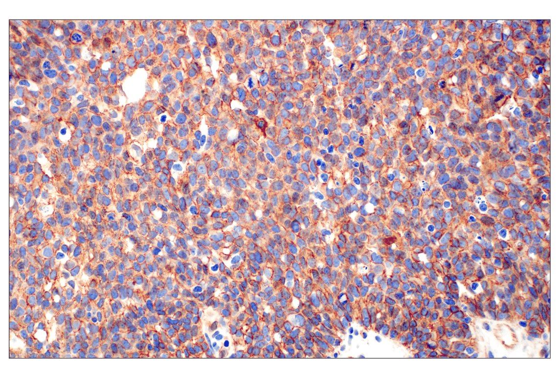 undefined Image 27: Cadherin-Catenin Antibody Sampler Kit