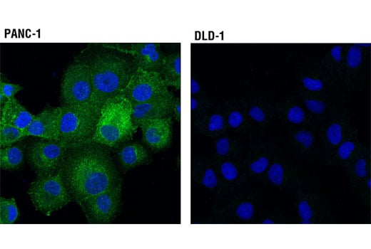 undefined Image 23: MHC Class I Antigen Processing and Presentation Antibody Sampler Kit