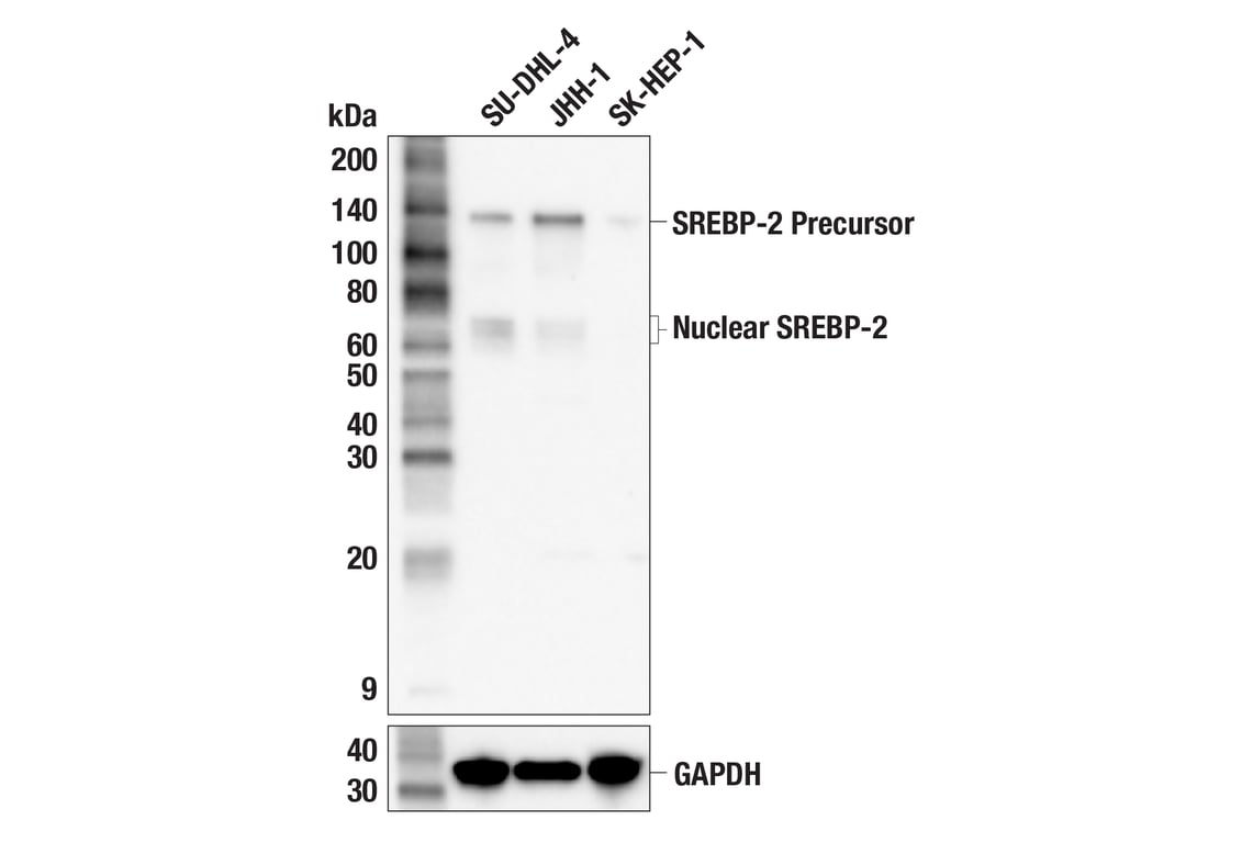 Western Blotting Image 1: SREBP-2 (F1X2D) Rabbit mAb