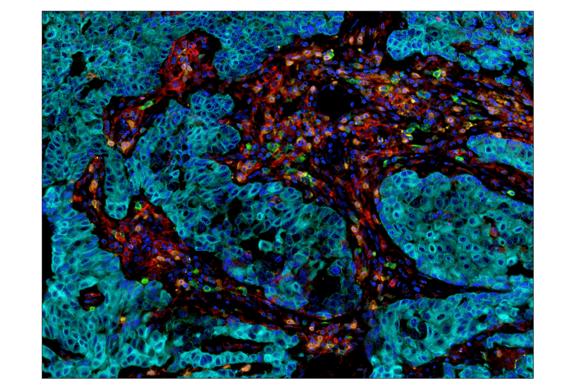 Immunohistochemistry Image 6: PD-L1 (E1L3N<sup>®</sup>) XP<sup>®</sup> Rabbit mAb