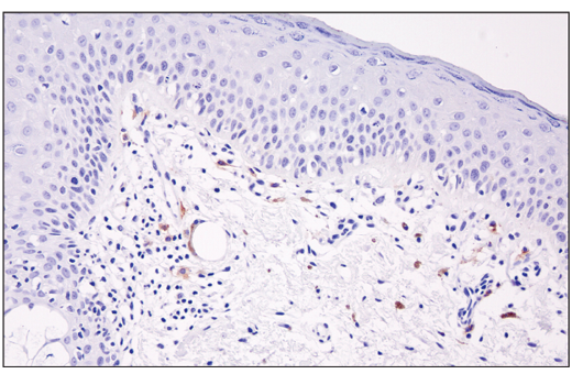 Immunohistochemistry Image 3: XCR1 (D2F8T) Rabbit mAb