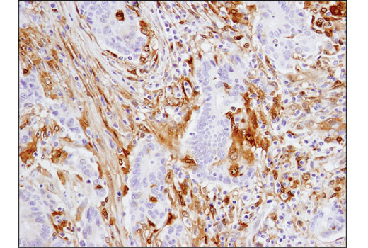 Immunohistochemistry Image 1: Galectin-9 (D9R4A) XP<sup>®</sup> Rabbit mAb (BSA and Azide Free)