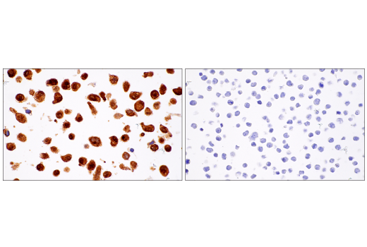 Immunohistochemistry Image 1: α-Synuclein (E4U2F) XP<sup>®</sup> Rabbit mAb (BSA and Azide Free)