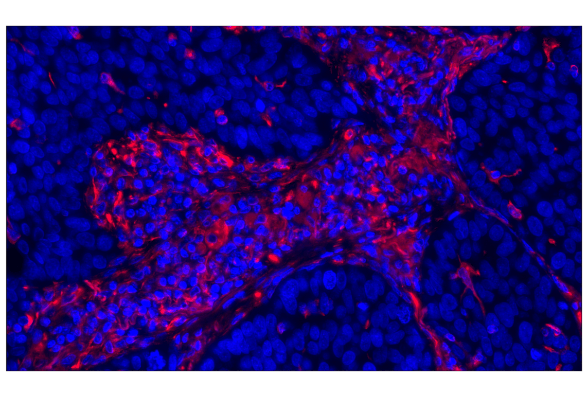 Vimentin (D21H3) XP® Rabbit mAb (Alexa Fluor® 555 Conjugate) | Cell ...