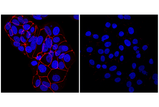 Immunofluorescence Image 1: ZO-1 (D6L1E) Rabbit mAb (Alexa Fluor<sup>®</sup> 647 Conjugate)