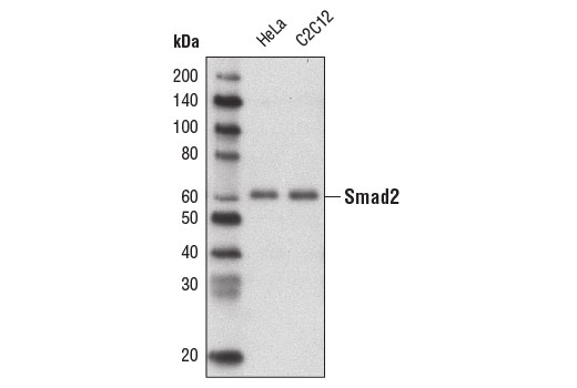 Western Blotting Image 1: Smad2 (D43B4) XP<sup>®</sup> Rabbit mAb (Biotinylated) 