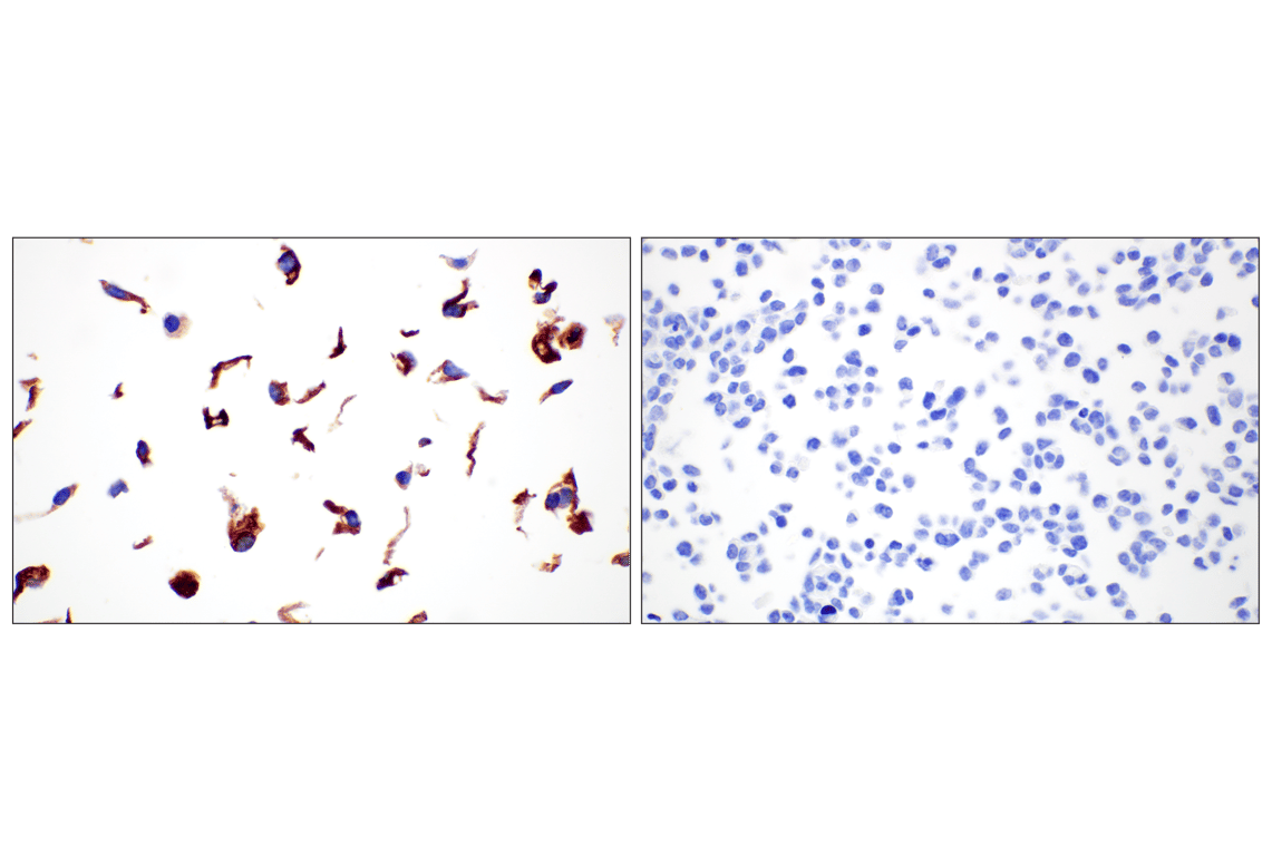 Immunohistochemistry Image 9: COL4A1 (E5M6R) Rabbit mAb (BSA and Azide Free)