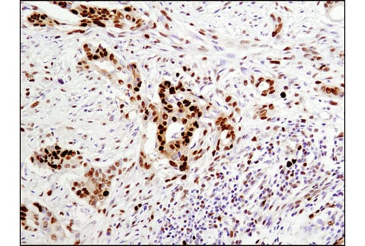 Immunohistochemistry Image 2: PCNA (D3H8P) XP<sup>®</sup> Rabbit mAb 